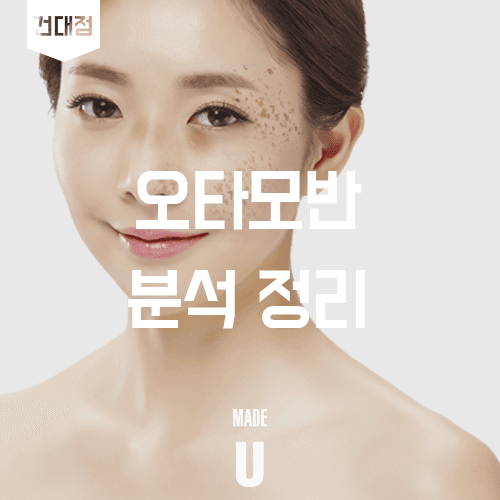 오타모반의 특징과 루비레이저 접근