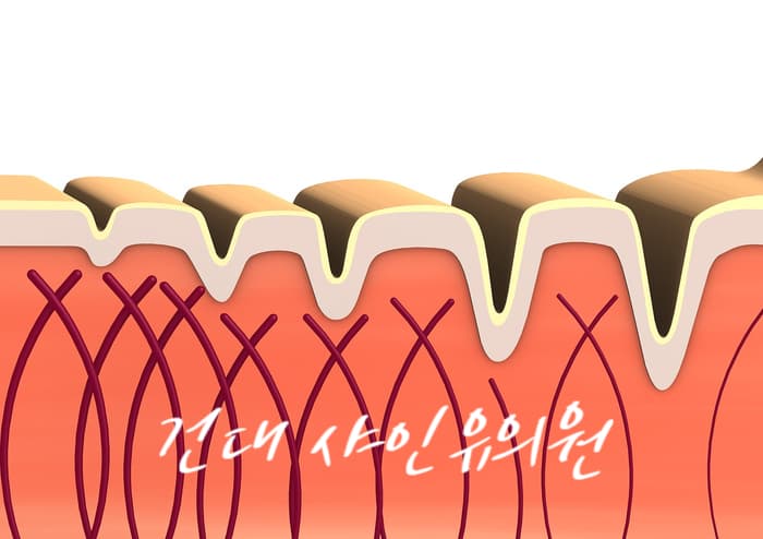 콜라겐 재생 볼륨 시술의 과정과 마사지 관리